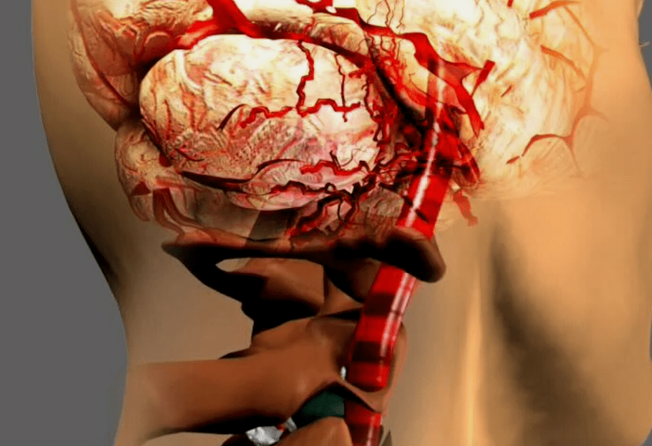 More than cervical joint disease is dangerous