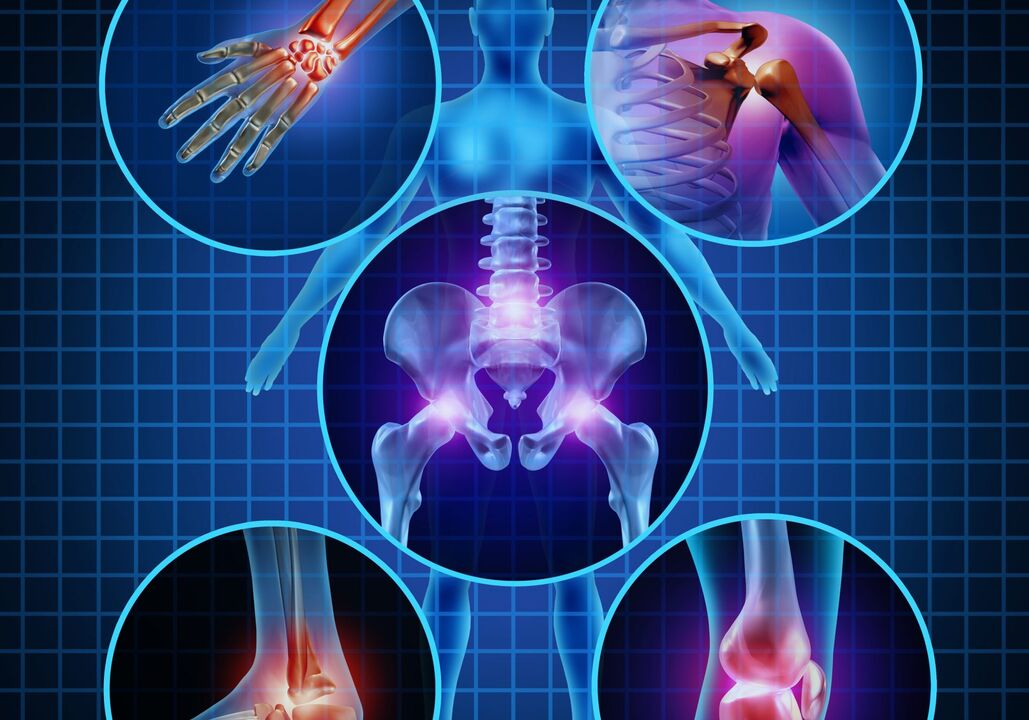 Joints can be affected by arthritis