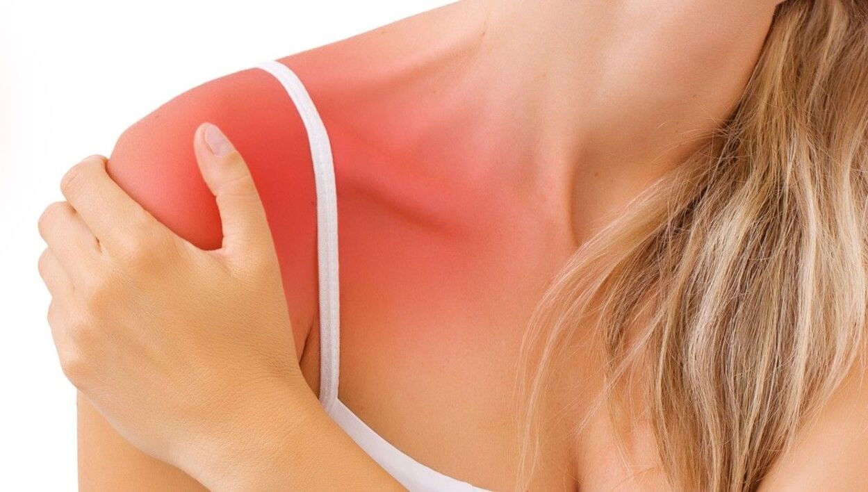Shoulder pain due to arthritis