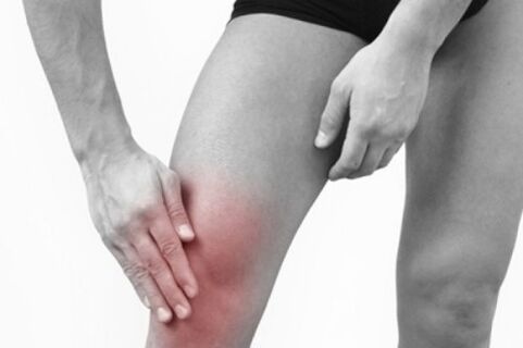 Knee pain due to arthritis photo 3