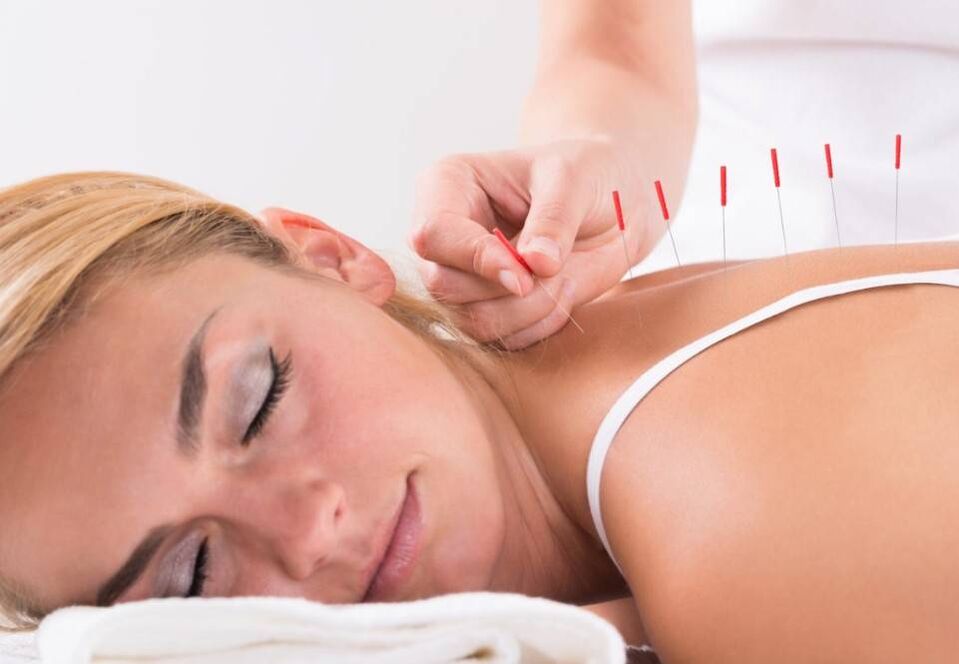 Acupuncture will help reduce pain when suffering from osteoarthritis