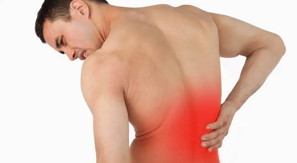 Back pain is a symptom of all stages of osteoarthritis