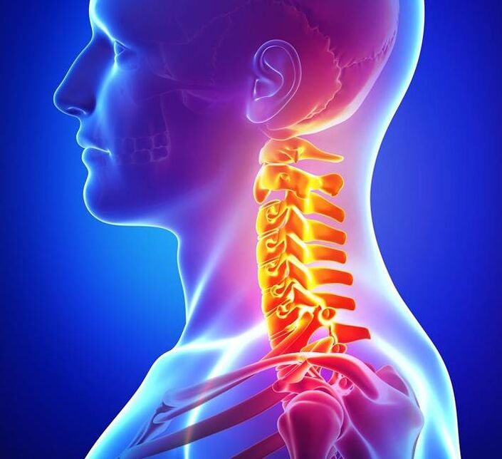 Cervical spine degeneration