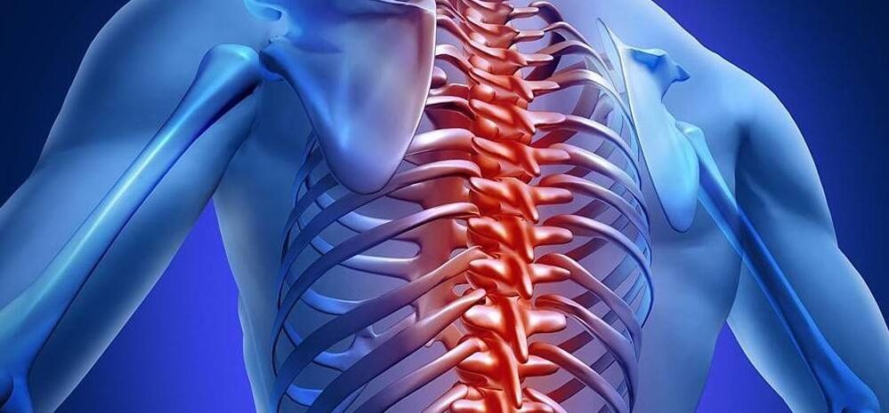 Osteoarthritis of the thoracic spine