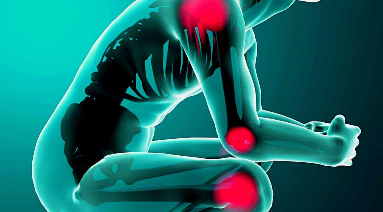 joint pain, treatment with Hondrolife